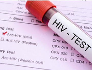 hiv testing centre